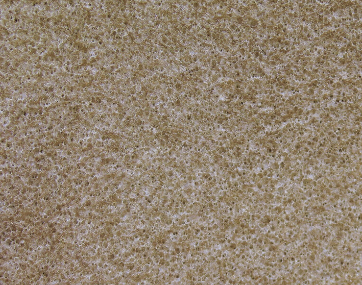 Hareline Furry Foam Is Great When Tying Terrestrial Trout Flies, Panfish Flies And Bass Flies